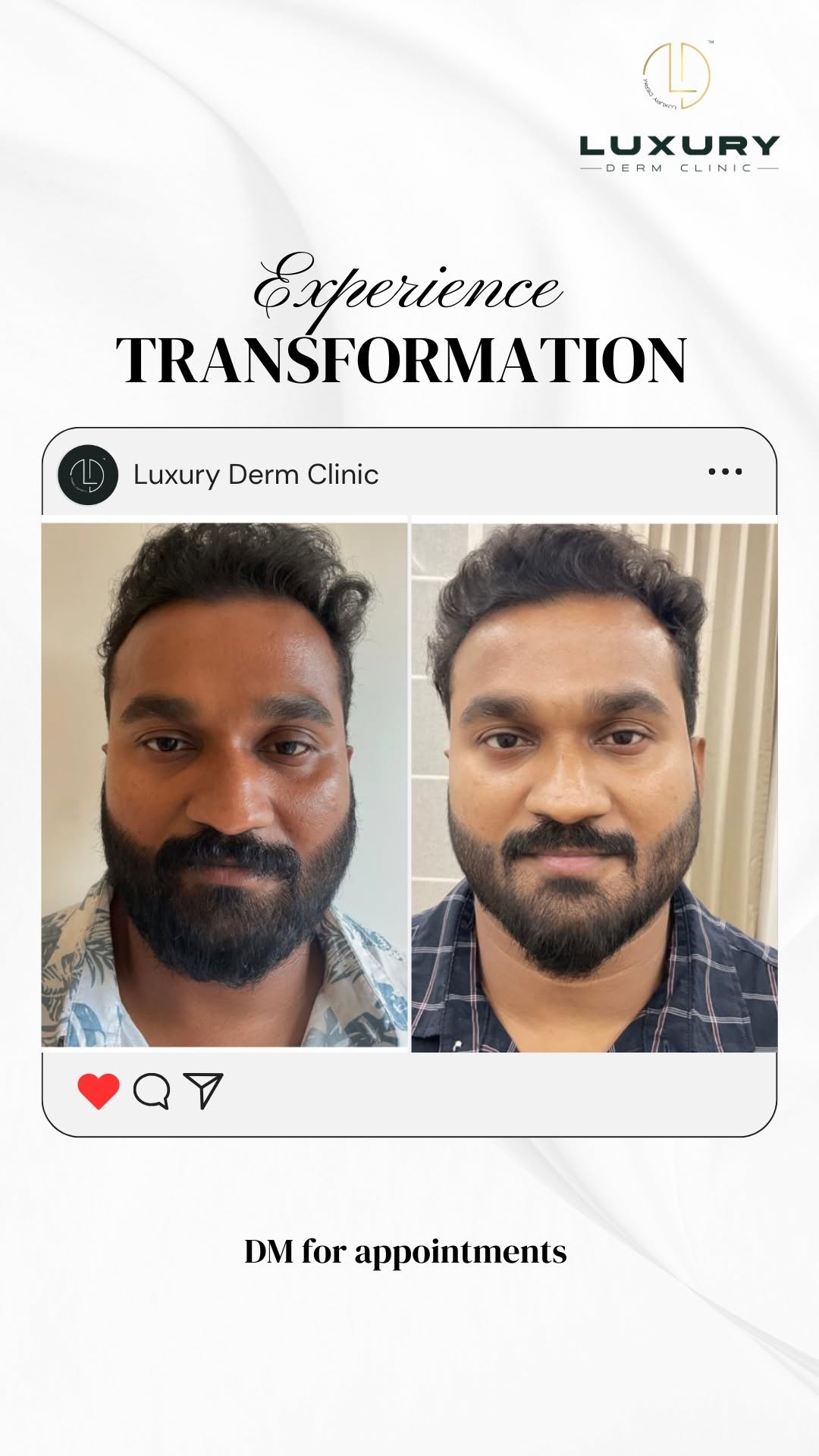 Ultraformer Skin Tightening