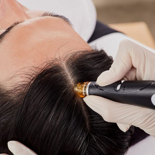 Hair Restoration